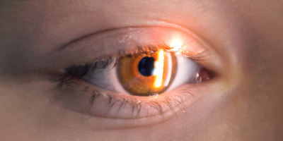 Retina Retina